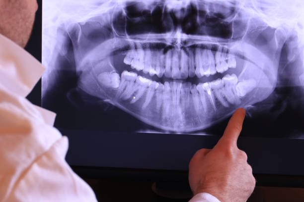 Best Emergency TMJ Treatment in Salem, MA